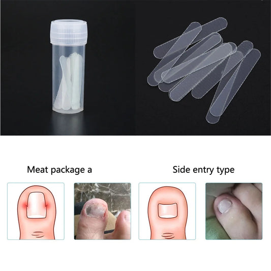 10Pcs Ingrown Toenail Physical Correcting Elastic Patches Pedicure Correction Tools, Foot Care Tools, Ingrown Toenail Correction Tools